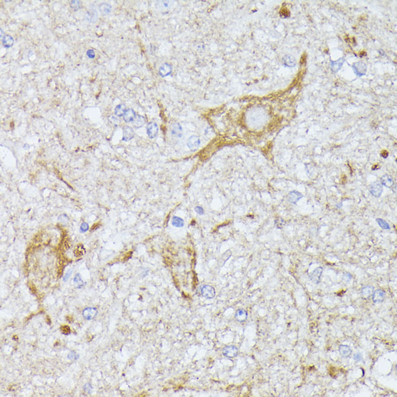 Immunohistochemistry of paraffin-embedded Mouse spinal cord using TBCA Polyclonal Antibody at dilution of  1:100 (40x lens).