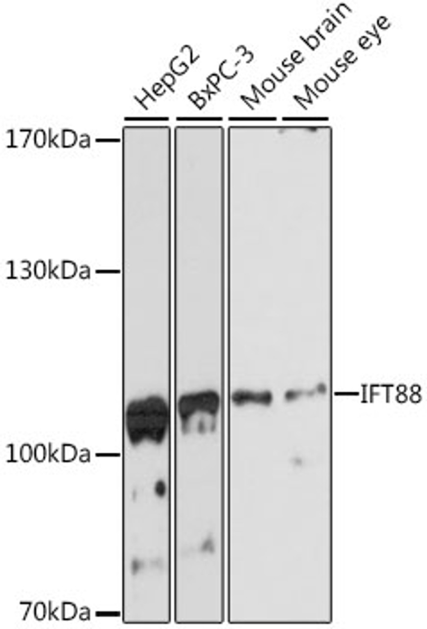 Western blot analysis of extracts of various cell lines using IFT88 Polyclonal Antibody at dilution of 1:3000.