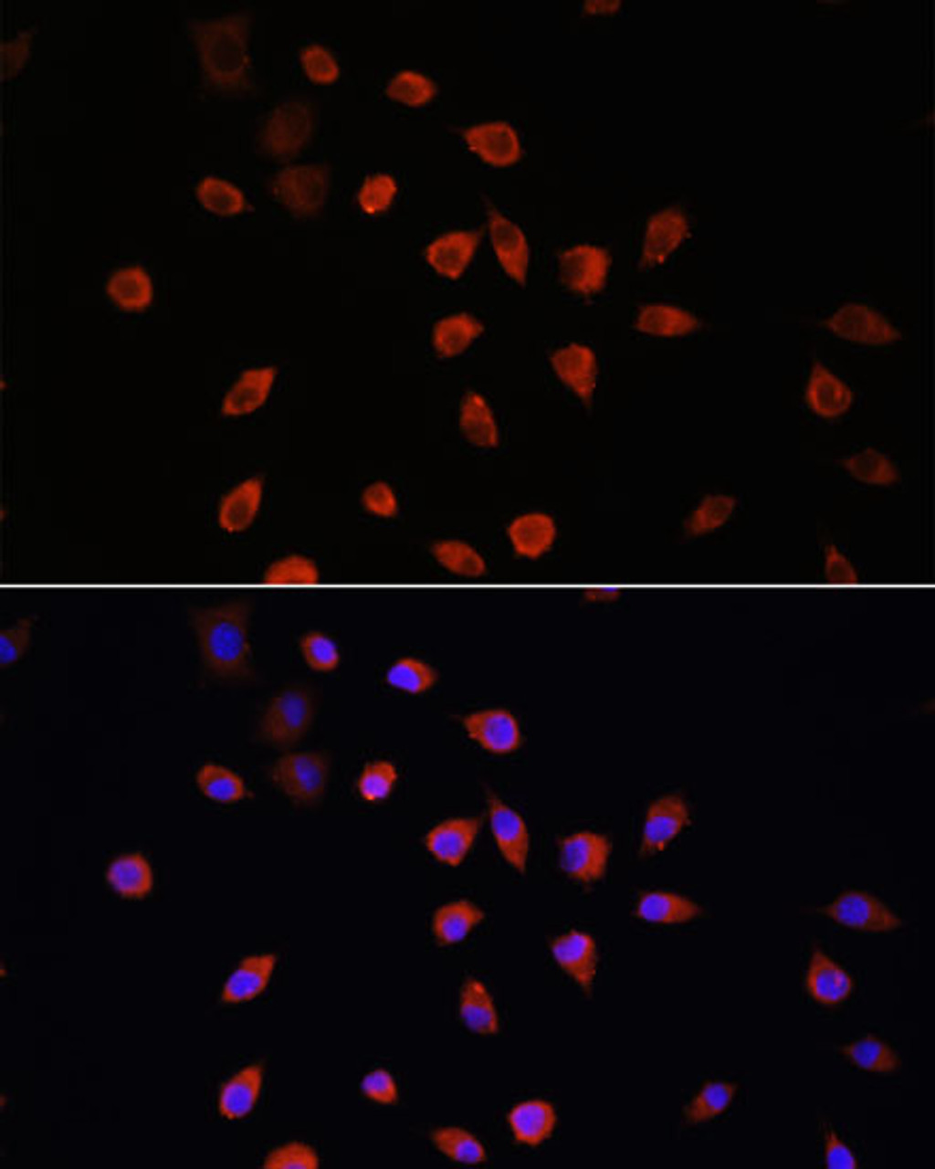 Immunofluorescence analysis of L929 cells using IFT88 Polyclonal Antibody at dilution of  1:100. Blue: DAPI for nuclear staining.