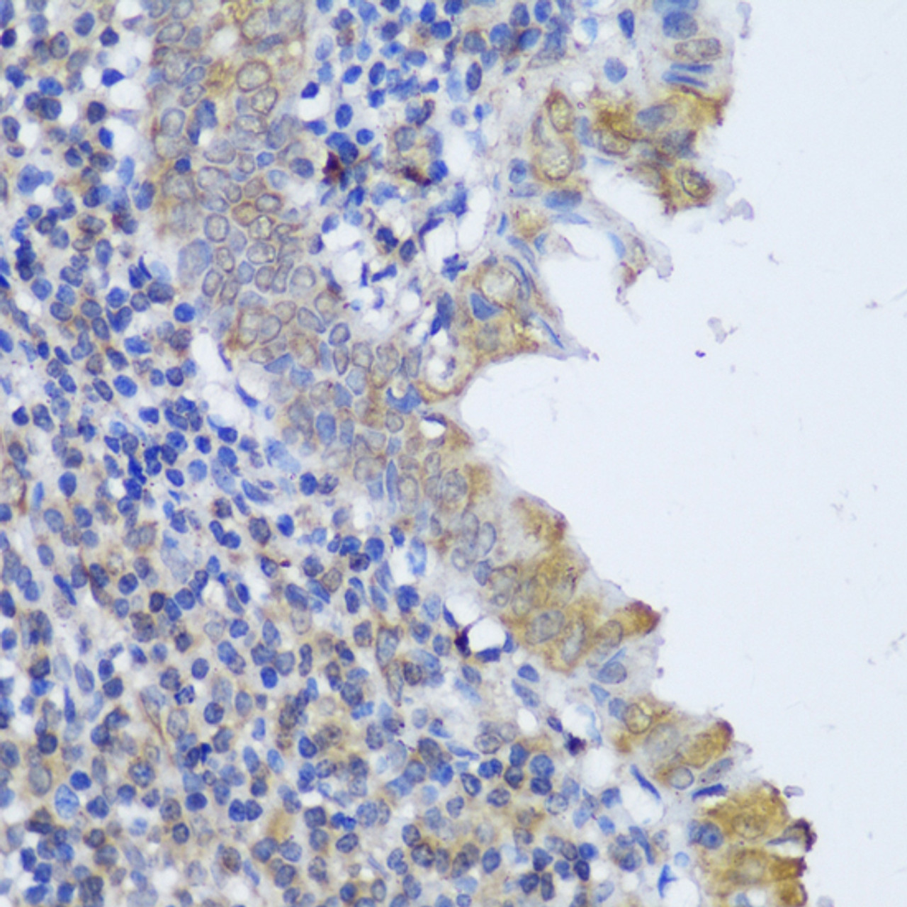 Immunohistochemistry of paraffin-embedded Human appendix using GCN1L1 Polyclonal Antibody at dilution of  1:150 (40x lens).