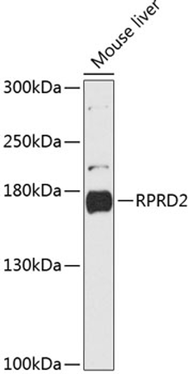 Western blot analysis of extracts of Mouse liver using RPRD2 Polyclonal Antibody at dilution of 1:3000.