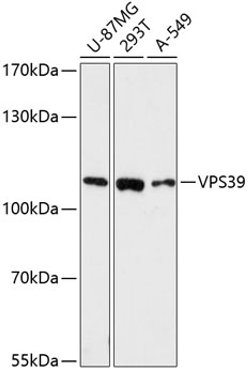 Western blot analysis of extracts of various cell lines using VPS39 Polyclonal Antibody at dilution of 1:3000.