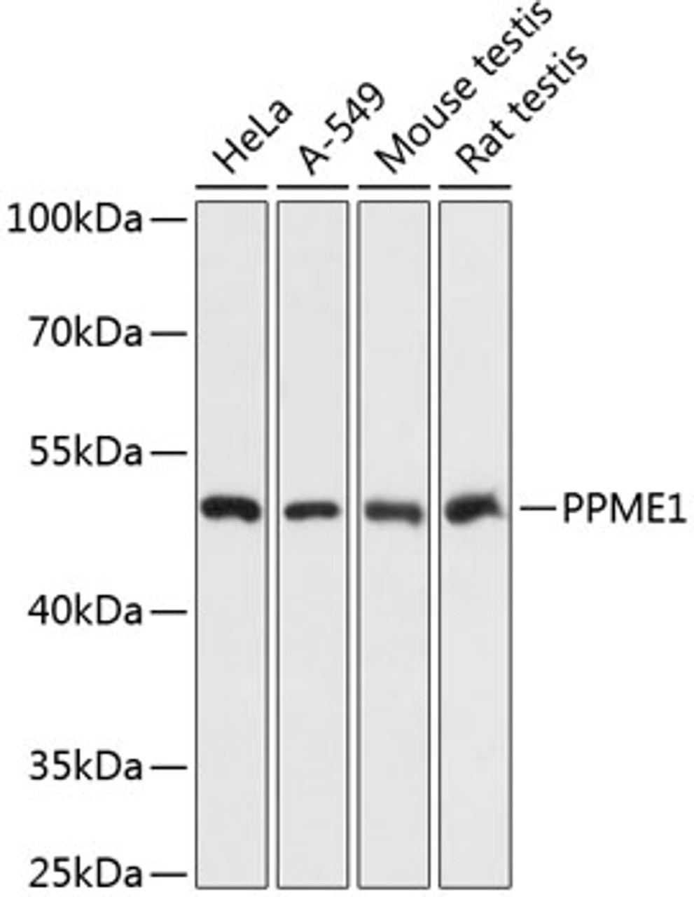 Western blot analysis of extracts of various cell lines using PPME1 Polyclonal Antibody at dilution of 1:3000.