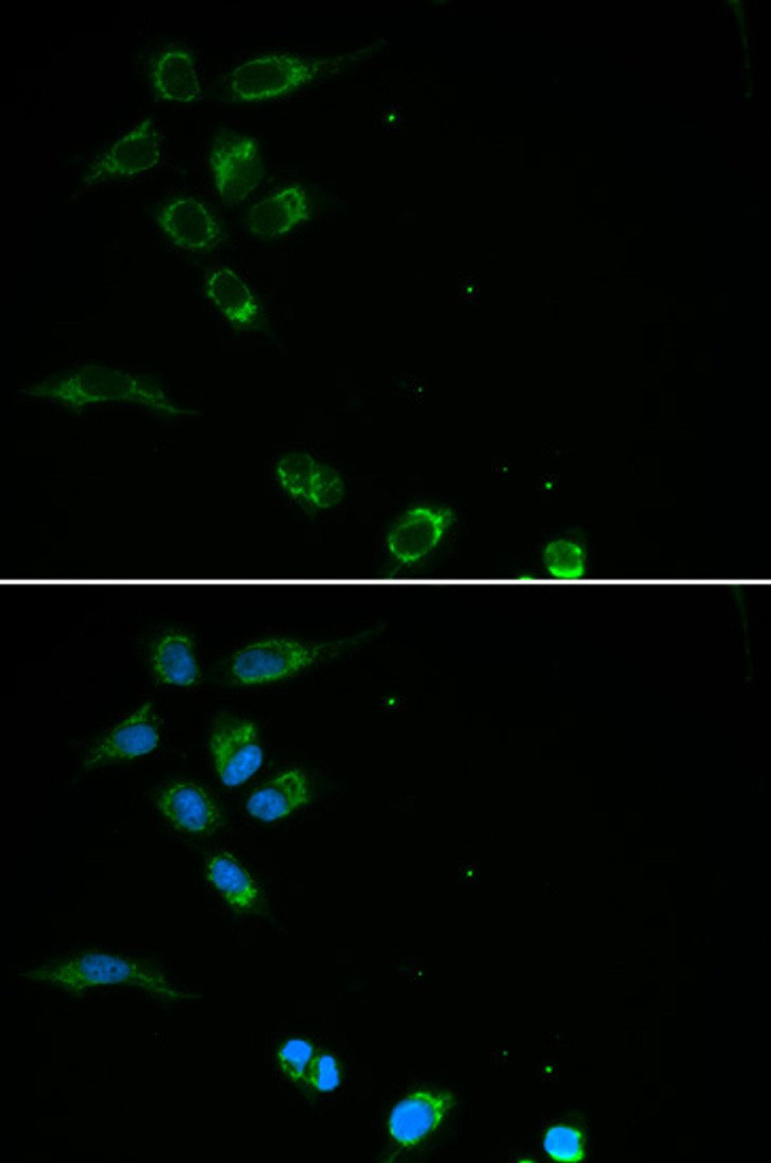 Immunofluorescence analysis of MCF-7 cells using HFE Polyclonal Antibody
