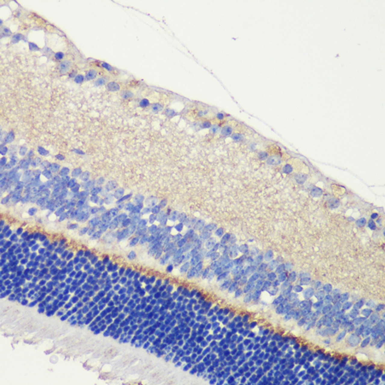Immunohistochemistry of paraffin-embedded Mouse retina using ANO2 Polyclonal Antibody at dilution of  1:200 (40x lens).