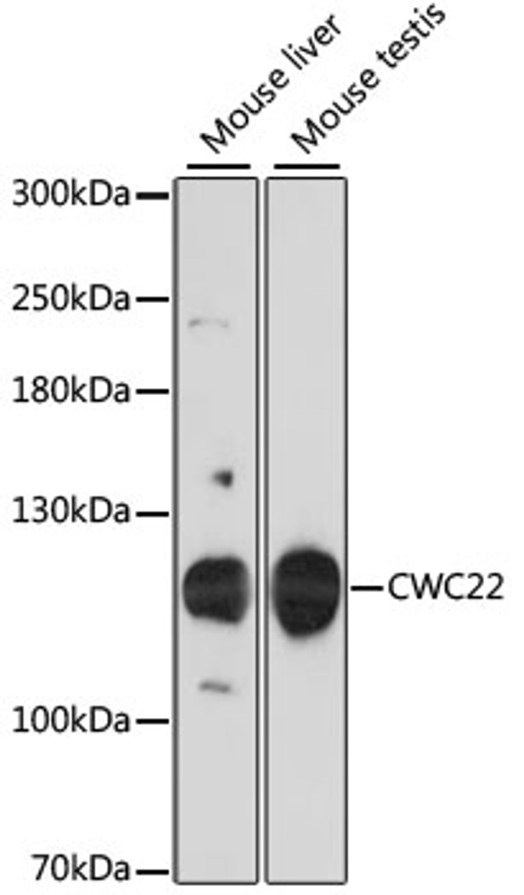 Western blot analysis of extracts of various cell lines using CWC22 Polyclonal Antibody at dilution of 1:3000.