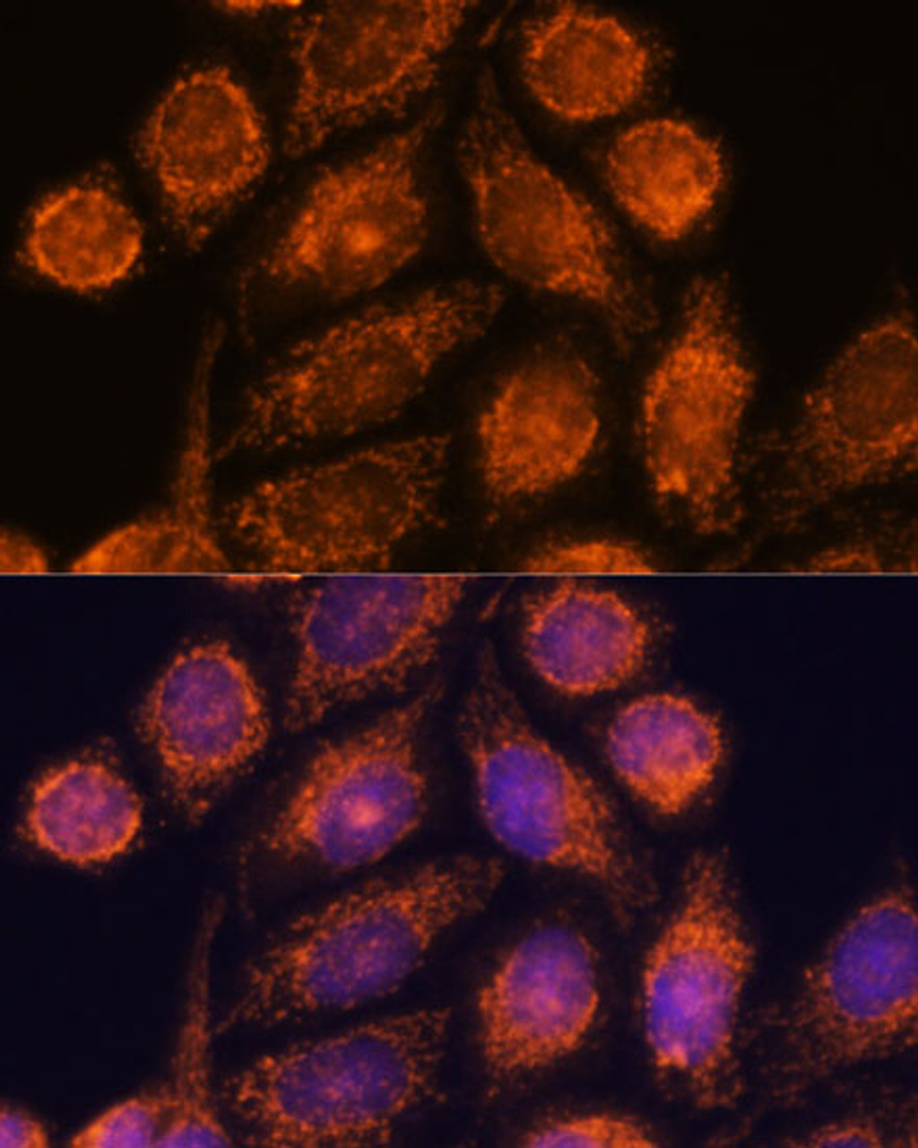 Immunofluorescence analysis of HeLa cells using MTMR9 Polyclonal Antibody at dilution of  1:100. Blue: DAPI for nuclear staining.