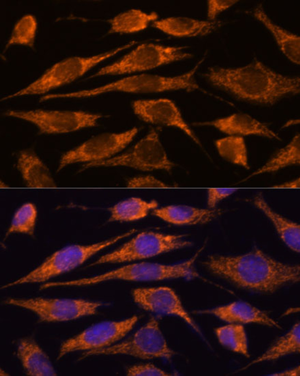Immunofluorescence analysis of L929 cells using MTMR9 Polyclonal Antibody at dilution of  1:100. Blue: DAPI for nuclear staining.