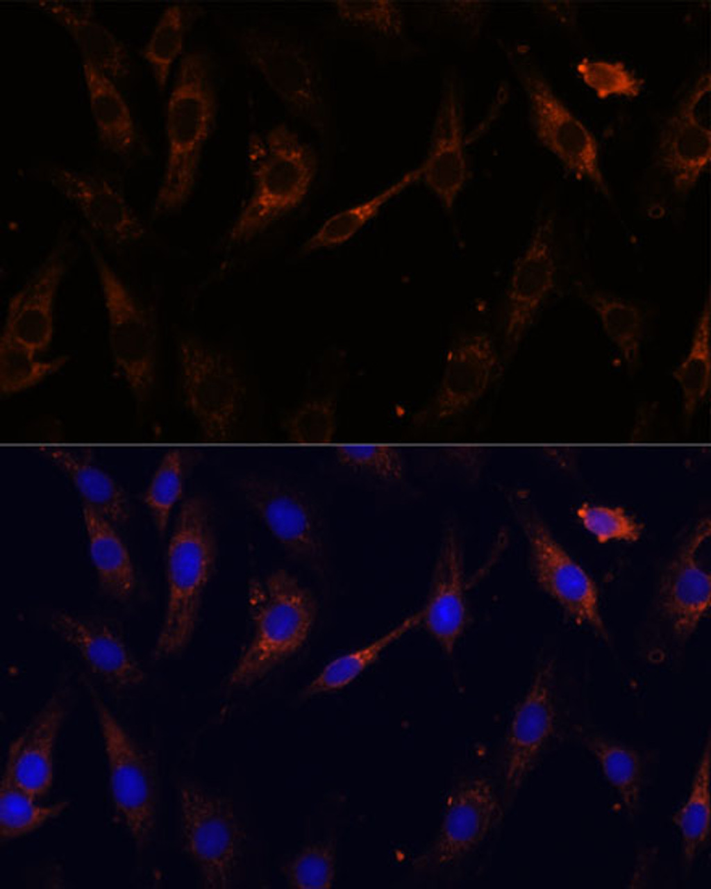 Immunofluorescence analysis of C6 cells using VPS25 Polyclonal Antibody at dilution of  1:100 (40x lens). Blue: DAPI for nuclear staining.