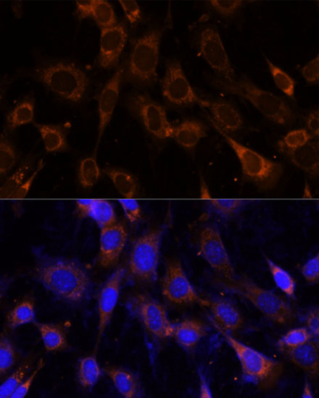 Immunofluorescence analysis of NIH-3T3 cells using VPS25 Polyclonal Antibody at dilution of  1:100 (40x lens). Blue: DAPI for nuclear staining.