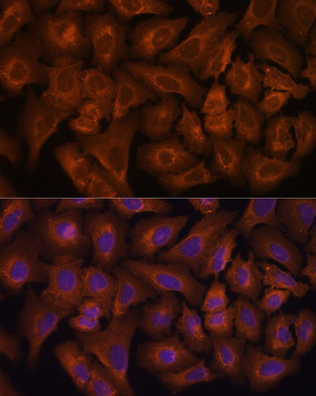 Immunofluorescence analysis of U-2 OS cells using NEXN Polyclonal Antibody at dilution of  1:100. Blue: DAPI for nuclear staining.