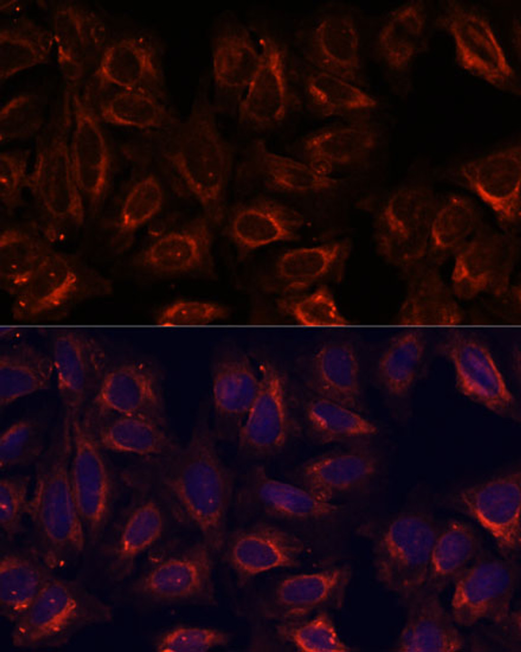 Immunofluorescence analysis of U-2 OS cells using SCGB3A2 Polyclonal Antibody at dilution of  1:100. Blue: DAPI for nuclear staining.