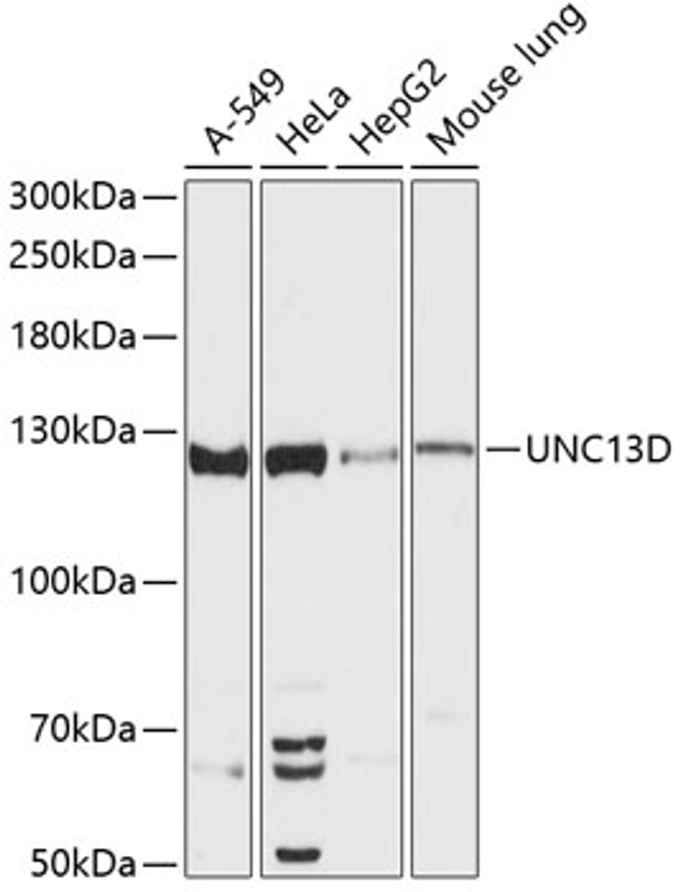 Western blot analysis of extracts of various cell lines using UNC13D Polyclonal Antibody at dilution of 1:3000.