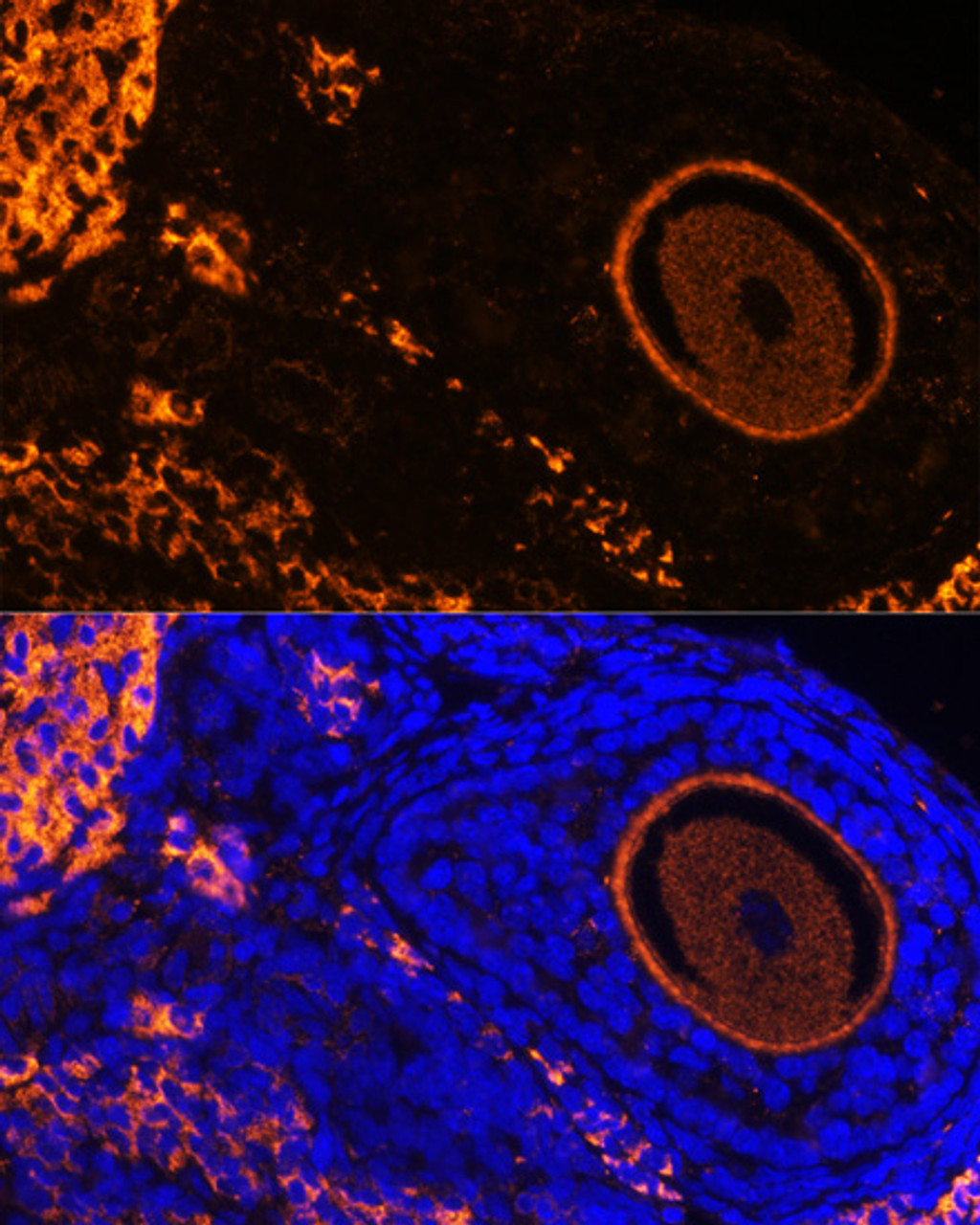 Immunofluorescence analysis of Rat oophoroma cells using ZP3 Polyclonal Antibody at dilution of  1:100. Blue: DAPI for nuclear staining.