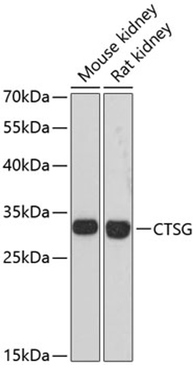 Western blot analysis of extracts of various cell lines using CTSG Polyclonal Antibody at dilution of 1:3000.