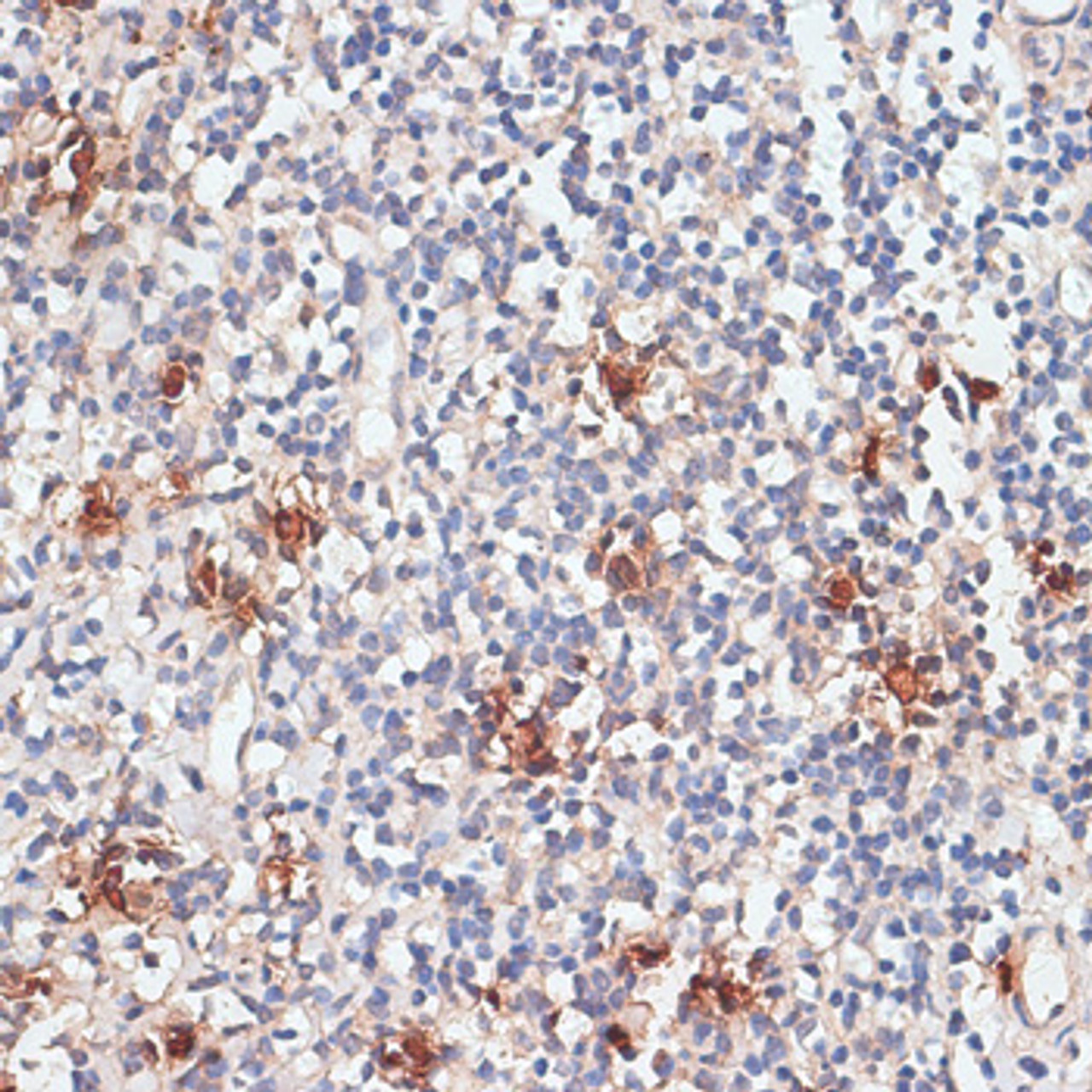 Immunohistochemistry of paraffin-embedded Human tonsil using CTSG Polyclonal Antibody at dilution of  1:100 (40x lens).