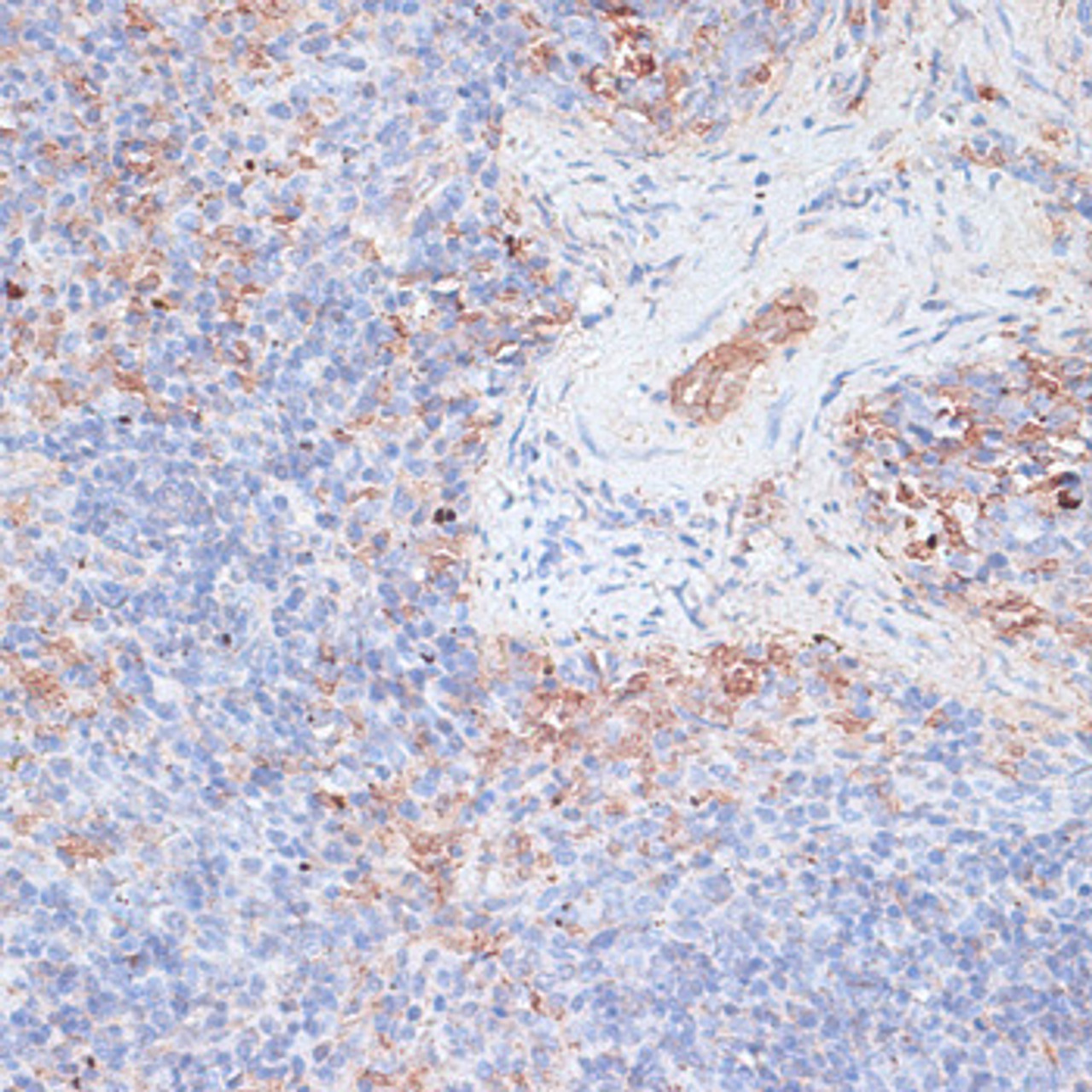 Immunohistochemistry of paraffin-embedded Mouse spleen using CTSG Polyclonal Antibody at dilution of  1:100 (40x lens).
