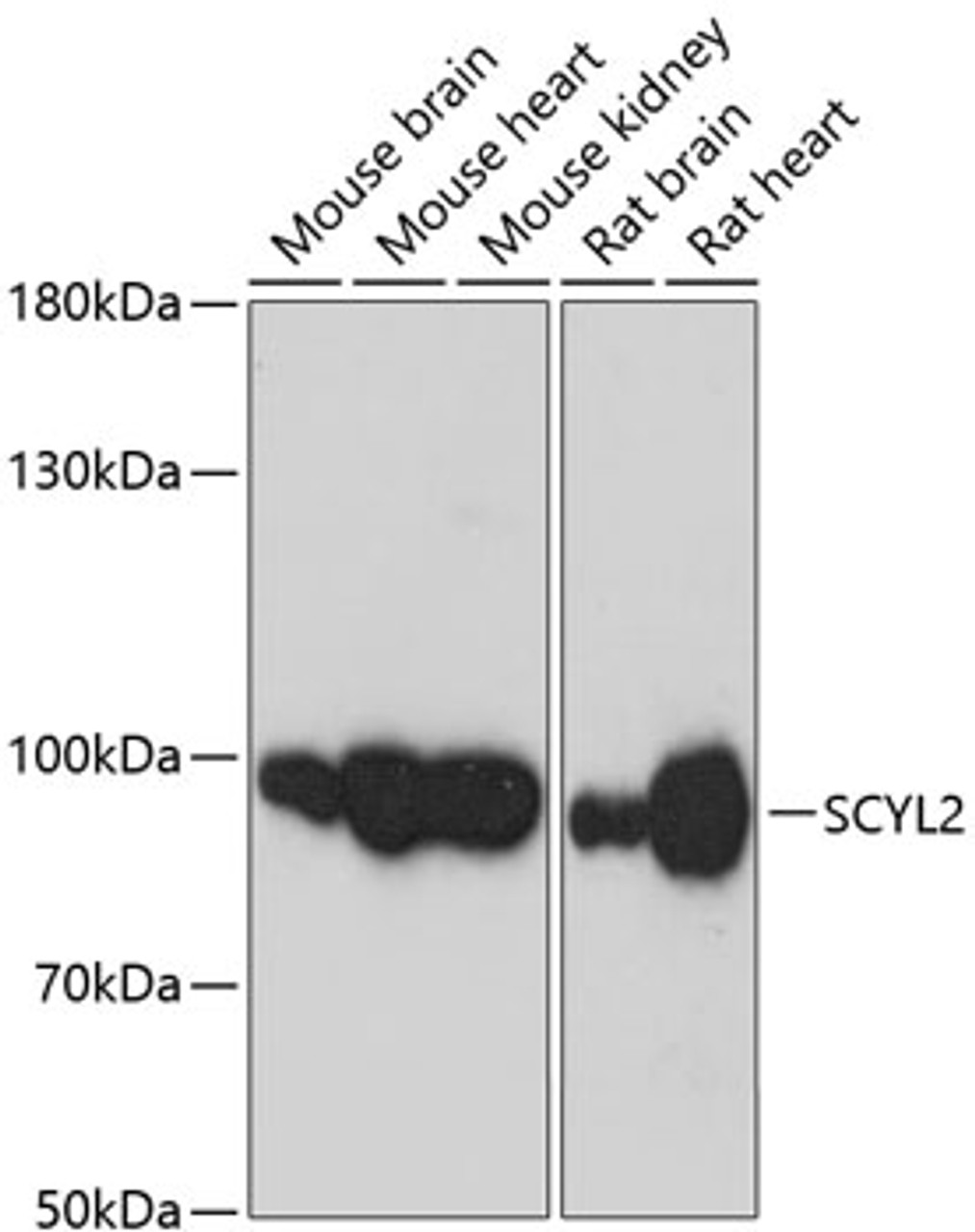 Western blot analysis of extracts of various cell lines using SCYL2 Polyclonal Antibody at dilution of 1:3000.