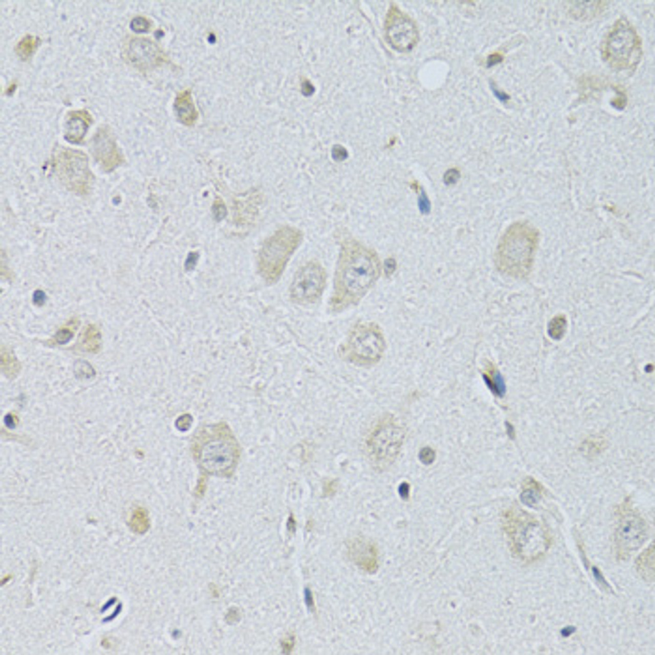 Immunohistochemistry of paraffin-embedded Rat brain using SLC29A1 Polyclonal Antibody at dilution of  1:100 (40x lens).