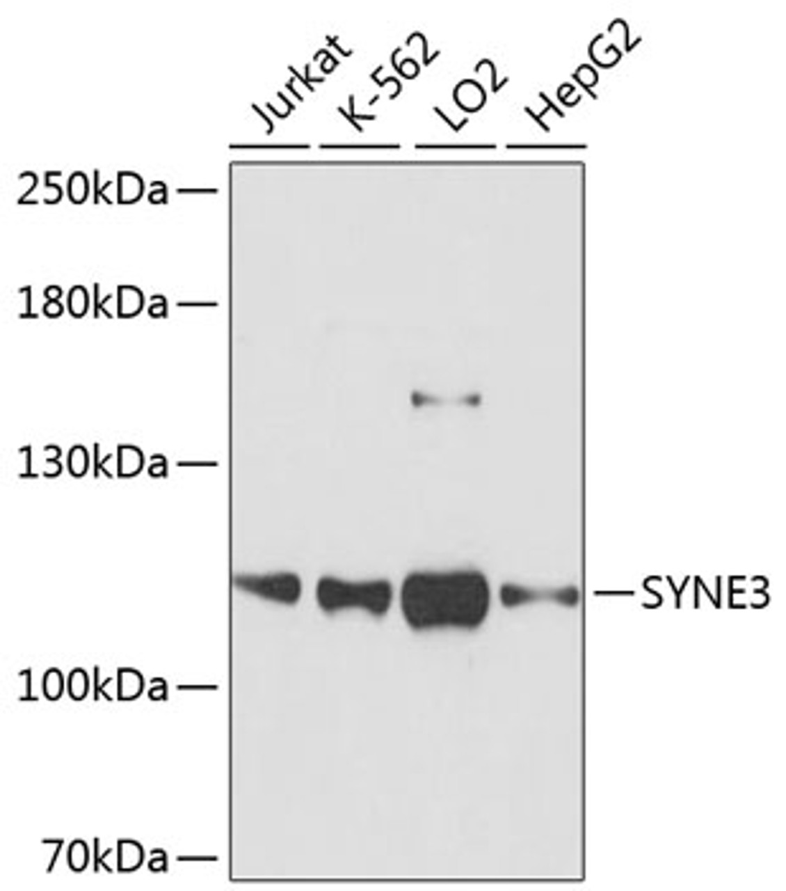 Western blot analysis of extracts of various cell lines using SYNE3 Polyclonal Antibody at dilution of 1:3000.