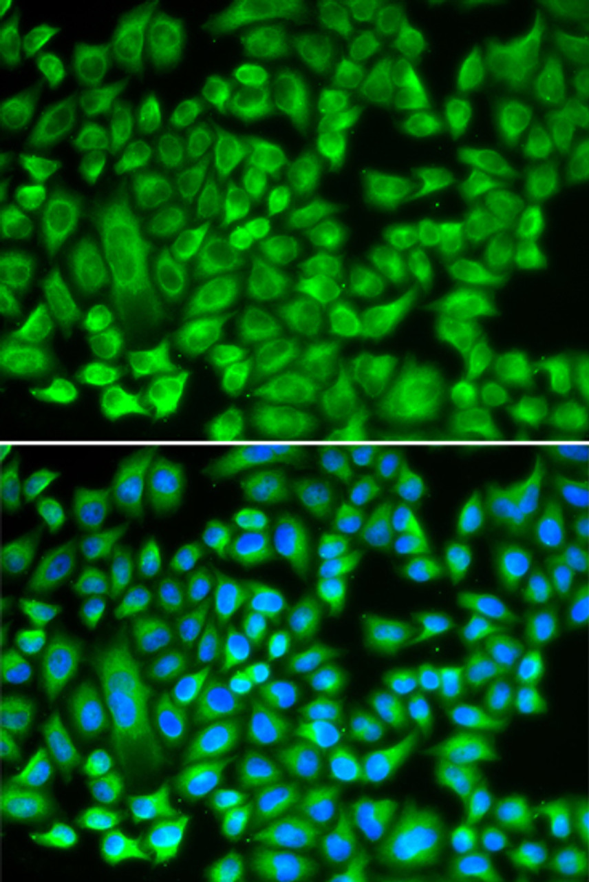 Immunofluorescence analysis of A549 cells using KAT5 Polyclonal Antibody