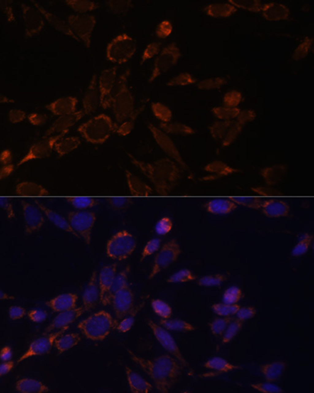 Immunofluorescence analysis of NIH-3T3 cells using ACAT1 Polyclonal Antibody at dilution of  1:100. Blue: DAPI for nuclear staining.