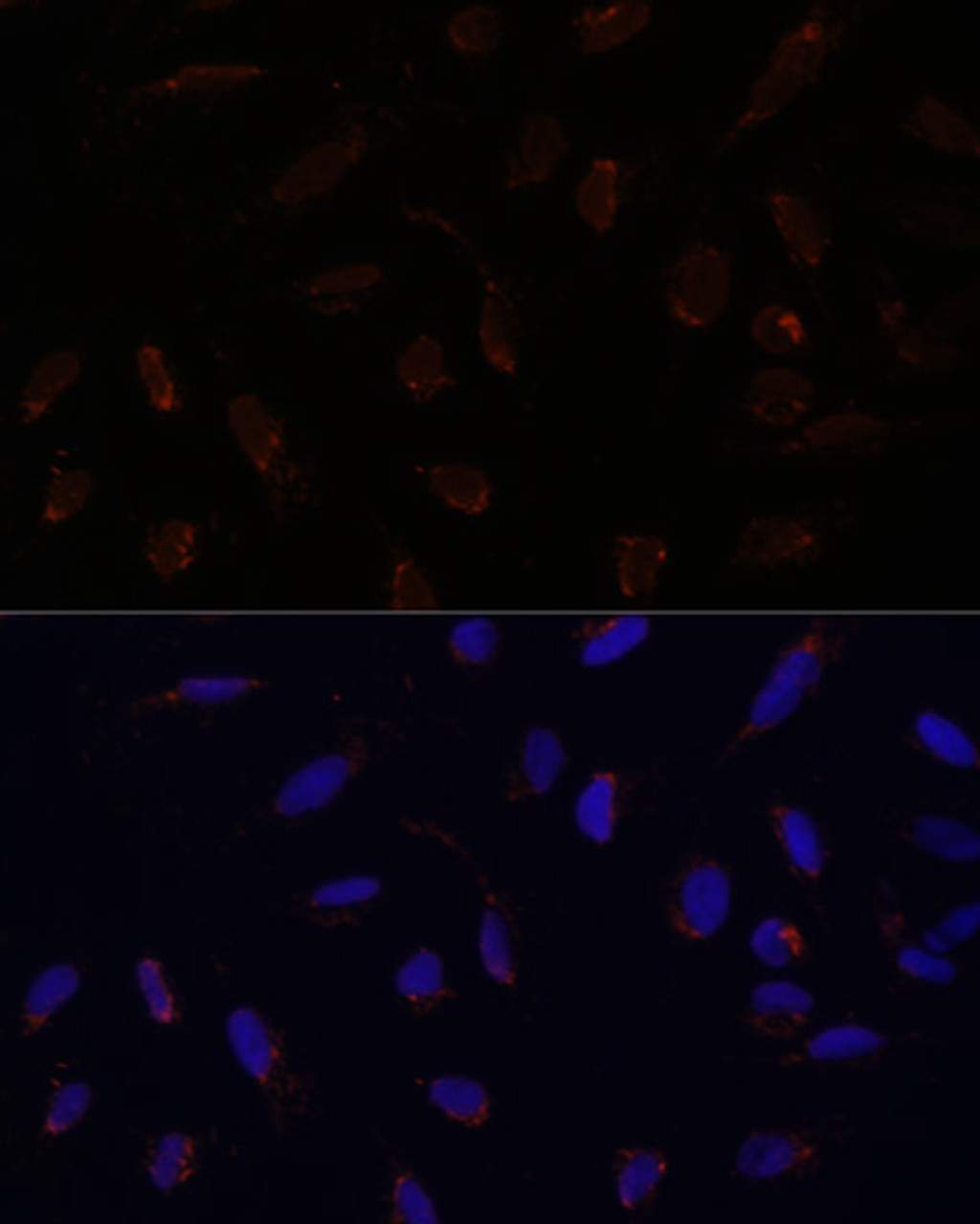 Immunofluorescence analysis of U-2 OS cells using ACAT1 Polyclonal Antibody at dilution of  1:100. Blue: DAPI for nuclear staining.