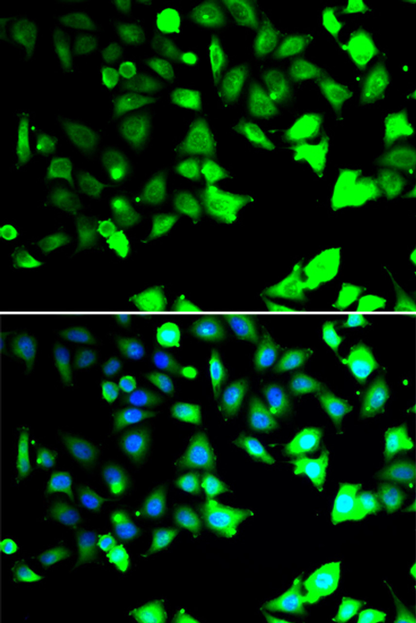 Immunofluorescence analysis of HeLa cells using XIAP Polyclonal Antibody