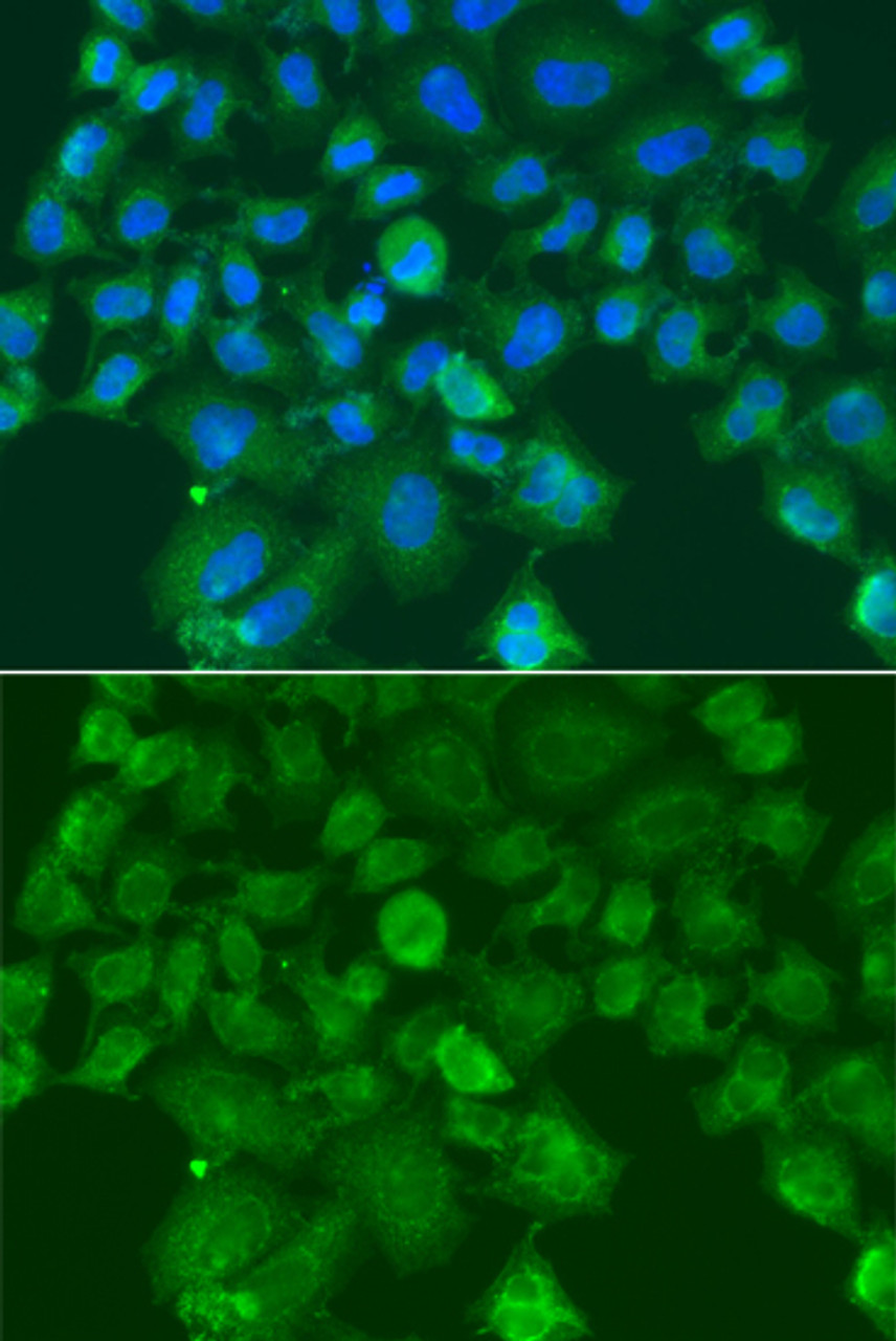Immunofluorescence analysis of A549 cells using CST1 Polyclonal Antibody