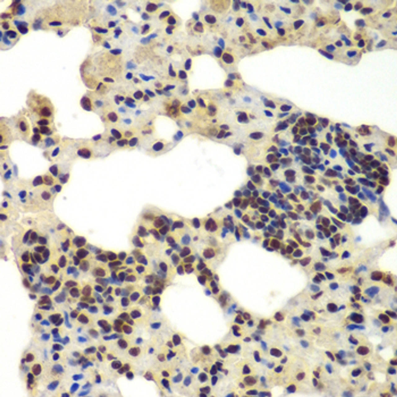 Immunohistochemistry of paraffin-embedded Rat lung using DDX5 Polyclonal Antibody at dilution of  1:100 (40x lens).