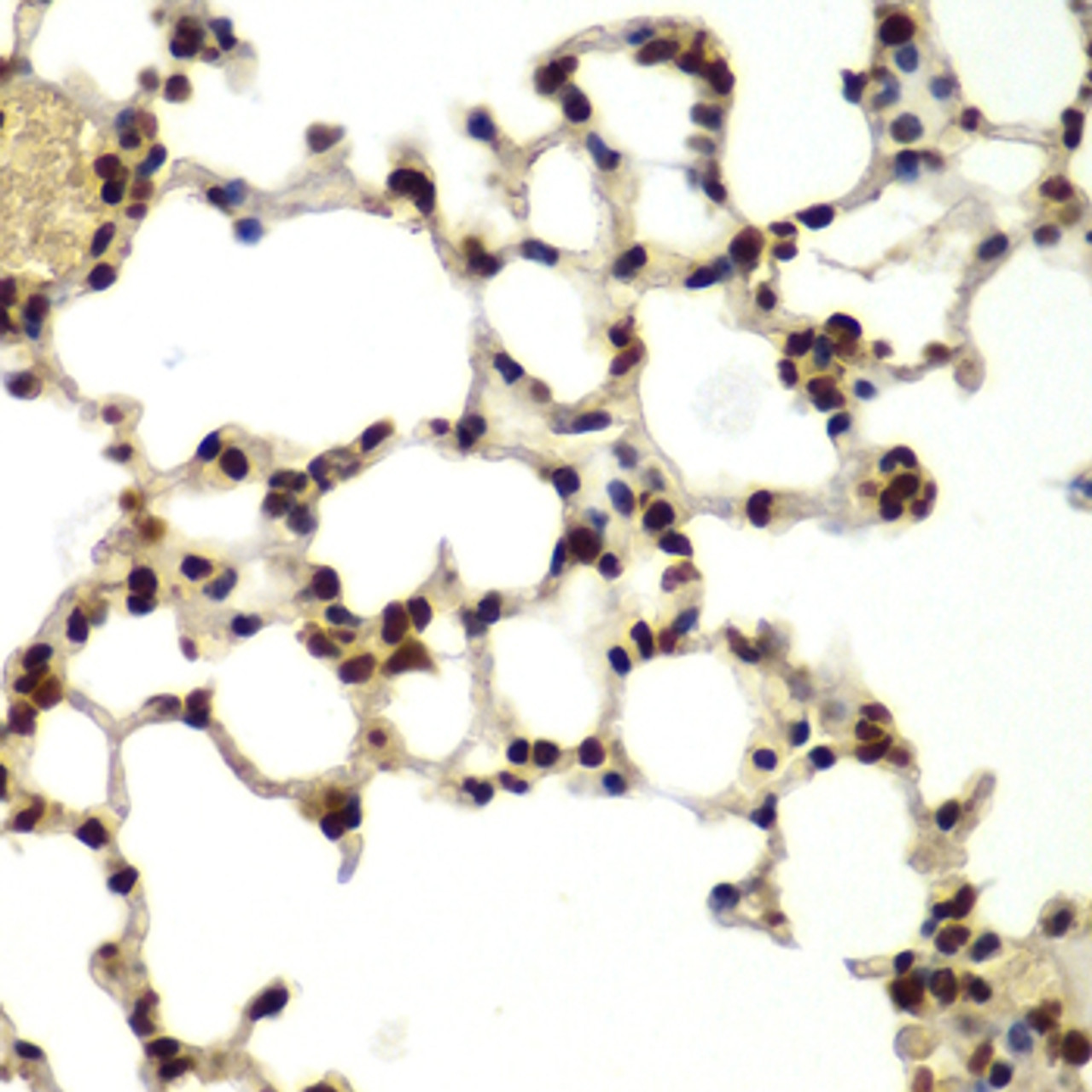Immunohistochemistry of paraffin-embedded Mouse lung using DDX5 Polyclonal Antibody at dilution of  1:100 (40x lens).