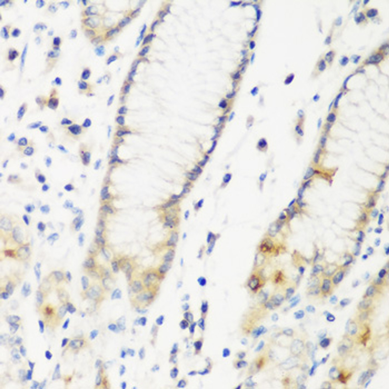Immunohistochemistry of paraffin-embedded Human stomach using DHODH Polyclonal Antibody at dilution of  1:200 (40x lens).