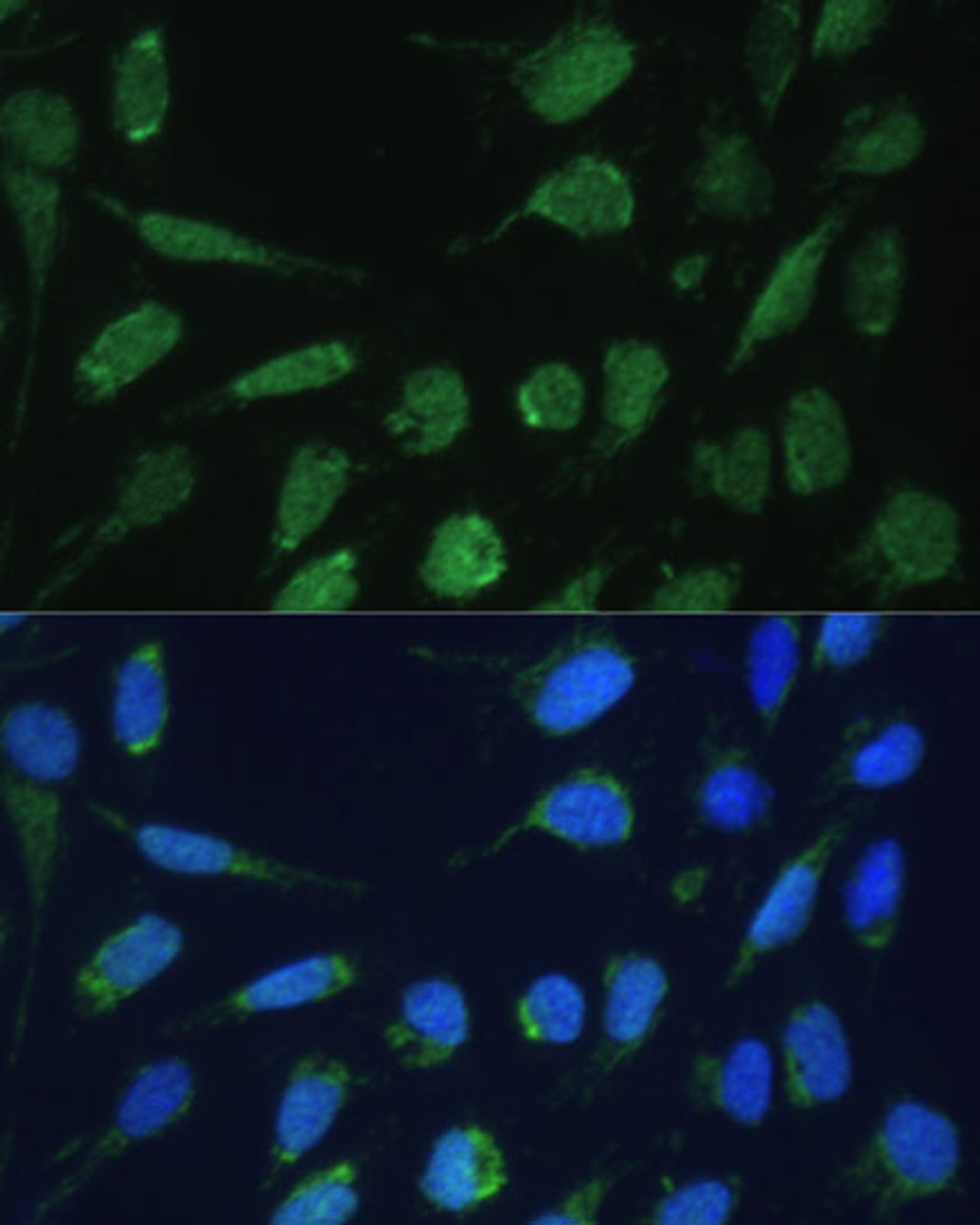 Immunofluorescence analysis of U-2 OS cells using DLST Polyclonal Antibody at dilution of  1:100 (40x lens). Blue: DAPI for nuclear staining.