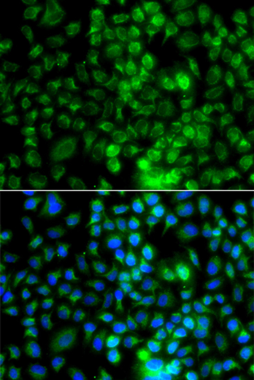 Immunofluorescence analysis of A549 cells using EPHA1 Polyclonal Antibody