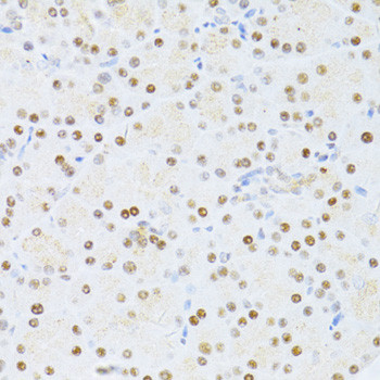 Immunohistochemistry of paraffin-embedded Rat pancreas using ETV1 Polyclonal Antibody at dilution of  1:100 (40x lens).