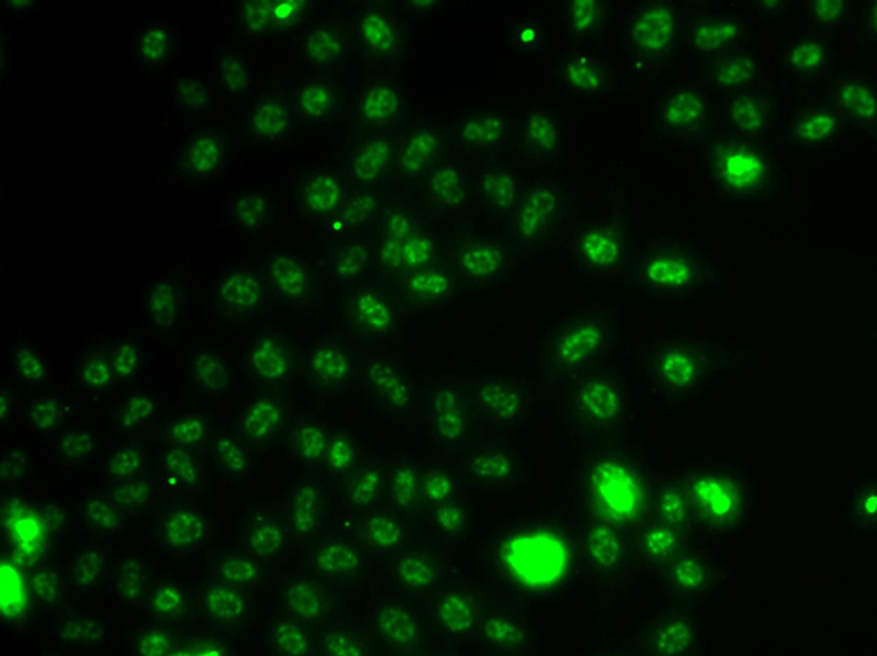 Immunofluorescence analysis of A549 cells using ETV1 Polyclonal Antibody