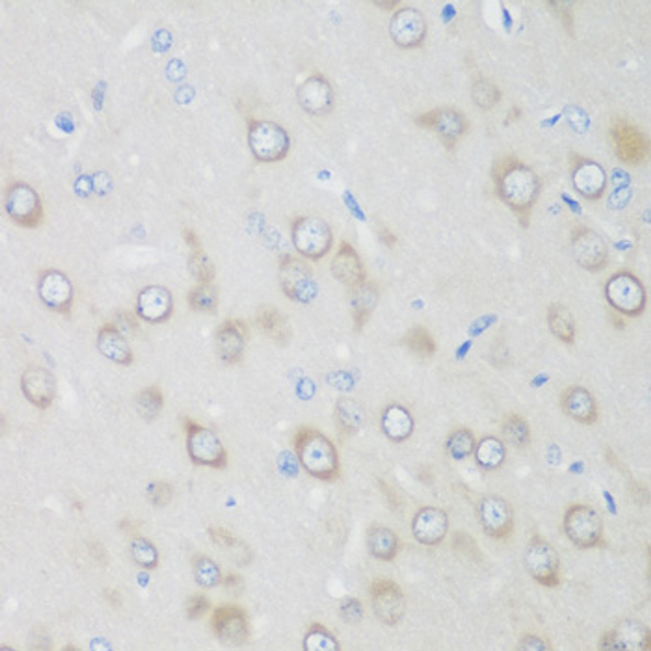 Immunohistochemistry of paraffin-embedded Rat brain using GPI Polyclonal Antibody at dilution of  1:200 (40x lens).