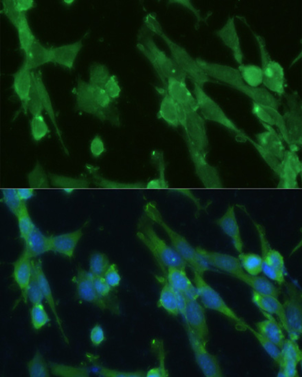 Immunofluorescence analysis of NIH-3T3 cells using GPI Polyclonal Antibody at dilution of  1:100. Blue: DAPI for nuclear staining.