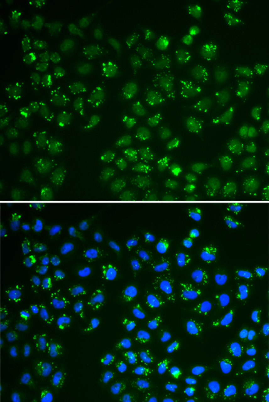 Immunofluorescence analysis of A549 cells using GPX4 Polyclonal Antibody