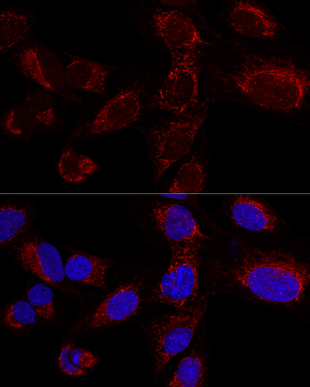 Confocal immunofluorescence analysis of U2OS cells using HADHA Polyclonal Antibody at dilution of  1:100. Blue: DAPI for nuclear staining.