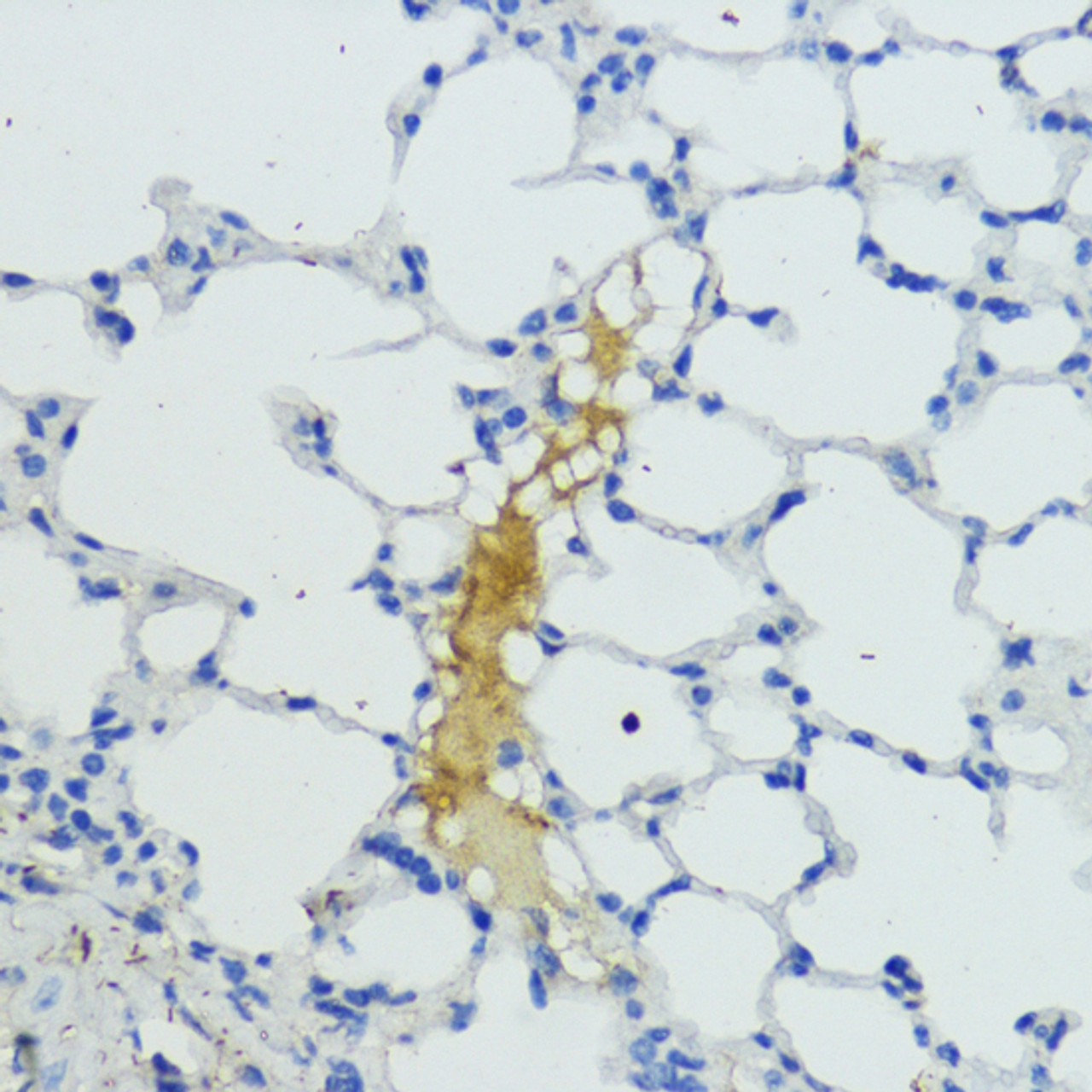 Immunohistochemistry of paraffin-embedded Mouse lung using KLKB1 Polyclonal Antibody at dilution of  1:200 (40x lens).