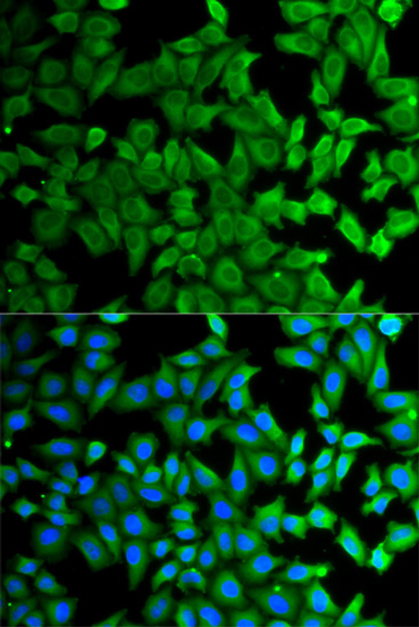 Immunofluorescence analysis of HeLa cells using KLKB1 Polyclonal Antibody