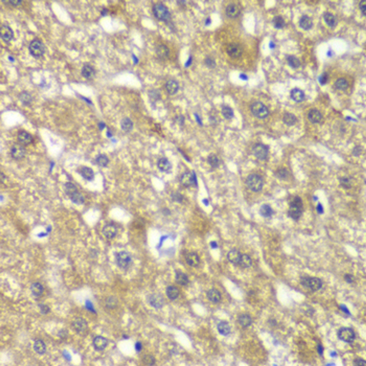 Immunohistochemistry of paraffin-embedded Human liver damage using MYBPC2 Polyclonal Antibody at dilution of  1:100 (40x lens).