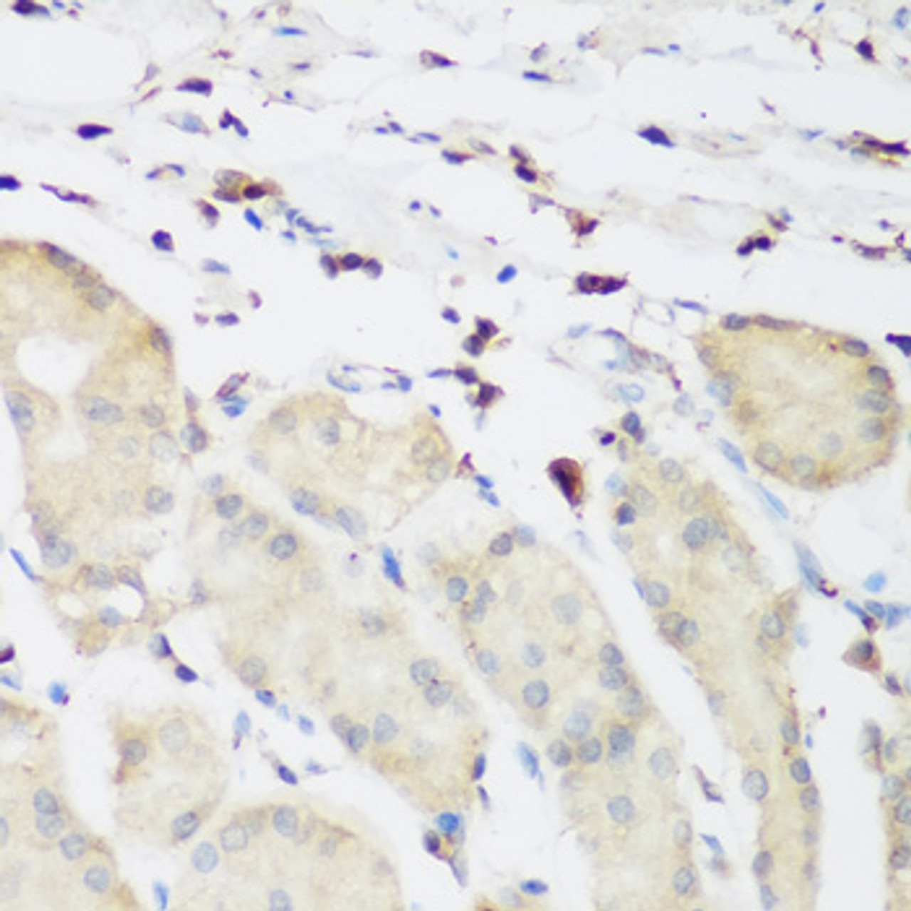 Immunohistochemistry of paraffin-embedded Human stomach using PLEK Polyclonal Antibody at dilution of  1:200 (40x lens).