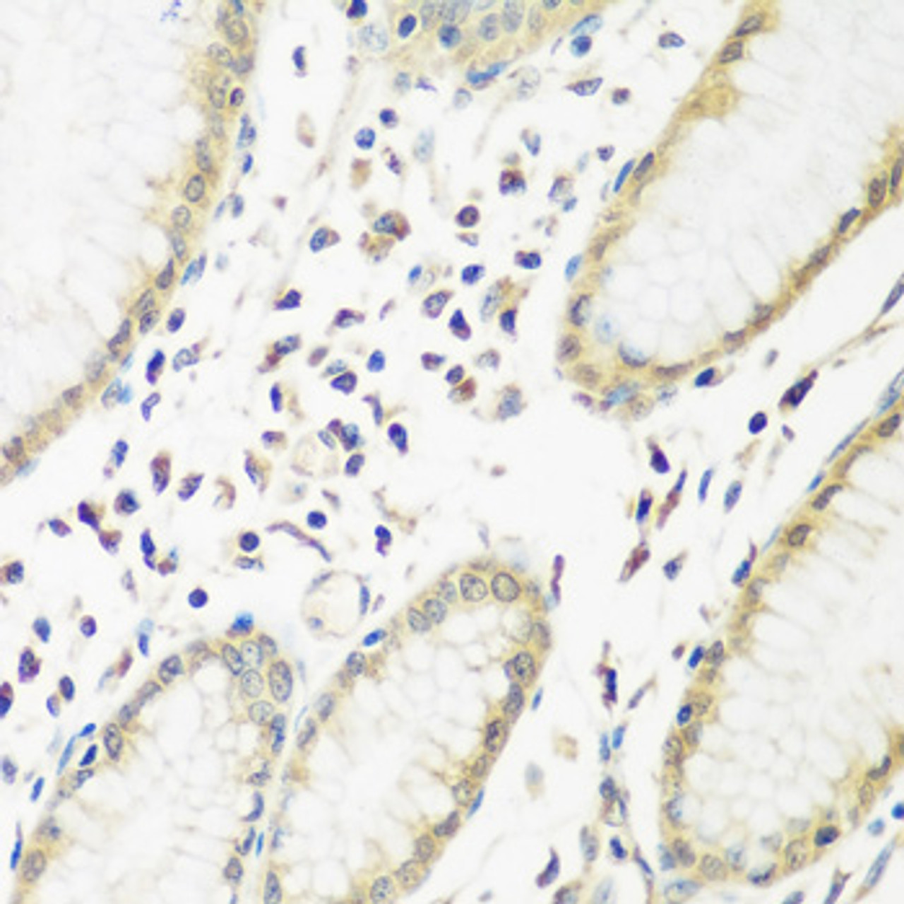 Immunohistochemistry of paraffin-embedded Human stomach using PYCR1 Polyclonal Antibody at dilution of  1:200 (40x lens).