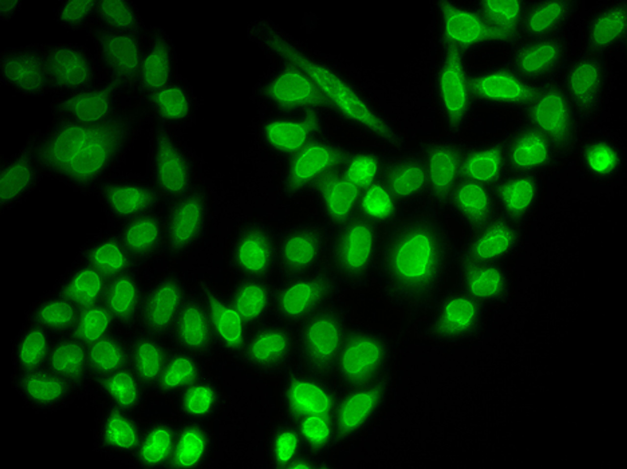 Immunofluorescence analysis of MCF-7 cells using RANGAP1 Polyclonal Antibody