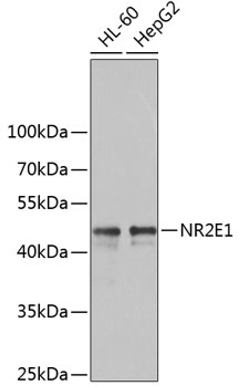 Western blot analysis of extracts of various cell lines using NR2E1 Polyclonal Antibody at dilution of 1:1000.