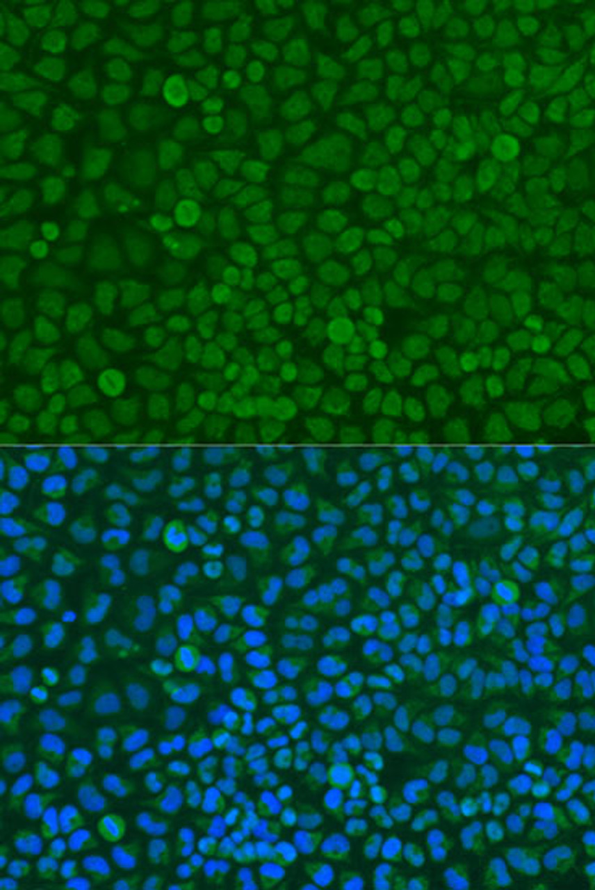 Immunofluorescence analysis of U2OS cells using YWHAZ Polyclonal Antibody at dilution of  1:100. Blue: DAPI for nuclear staining.