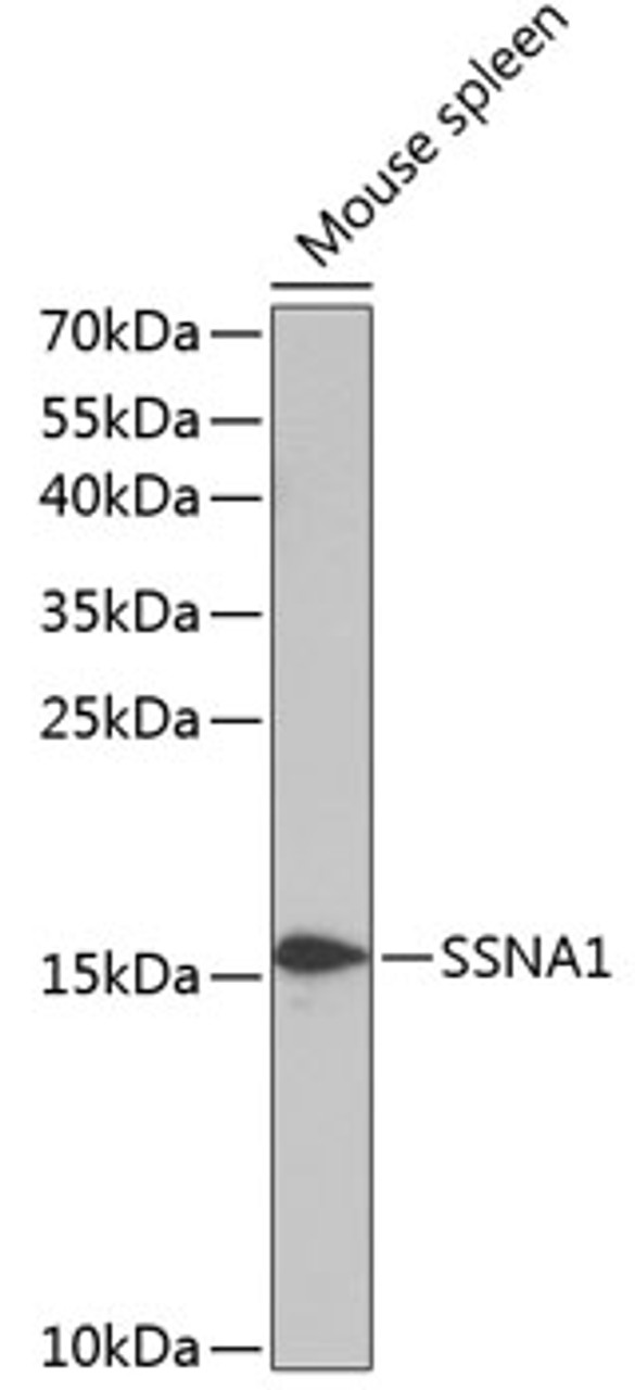 Western blot analysis of extracts of Mouse spleen using SSNA1 Polyclonal Antibody at dilution of 1:1000.