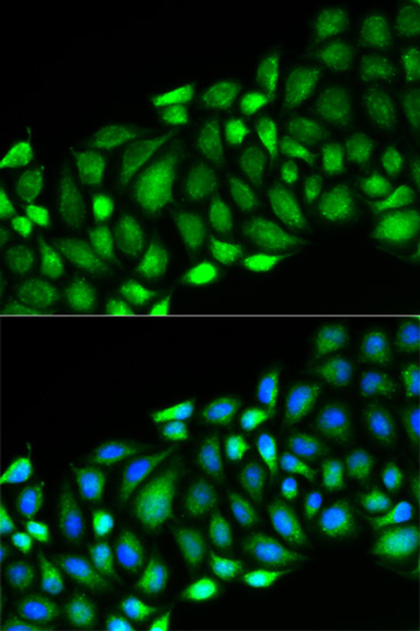Immunofluorescence analysis of HeLa cells using RIPK2 Polyclonal Antibody